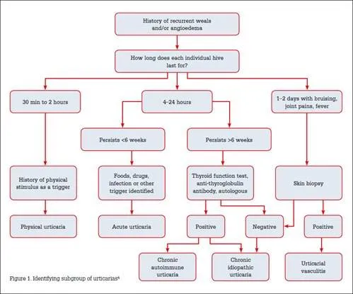 Urticaria