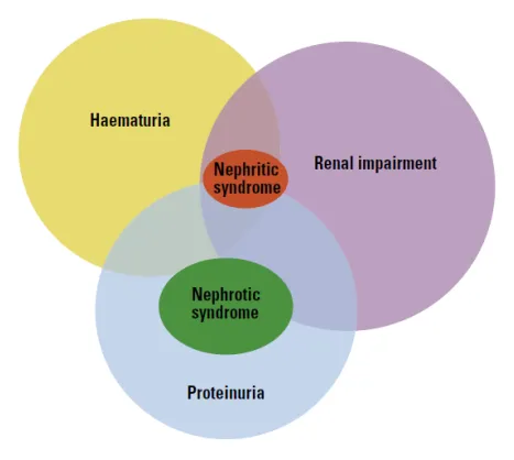 Haematuria assessment overview