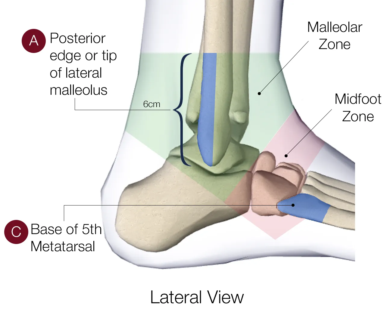 Malleolar zone — lateral view