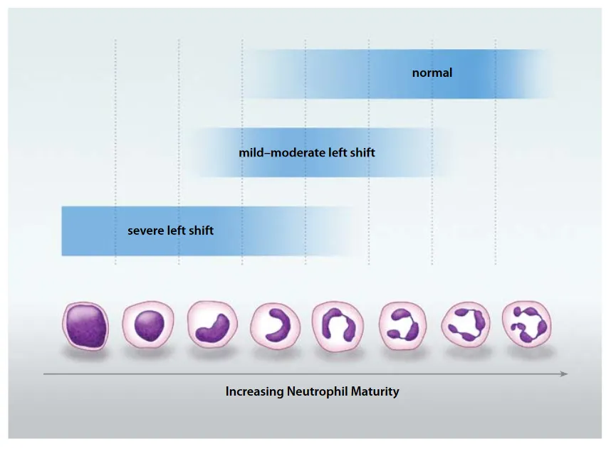 Neutrophil maturity spectrum and degree of left shift