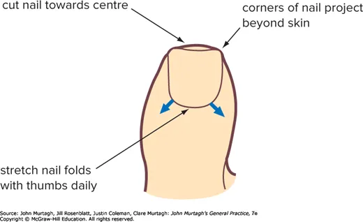 Method of fashioning toenails