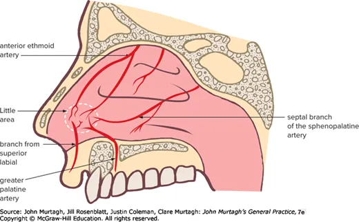 Sites of epistaxis