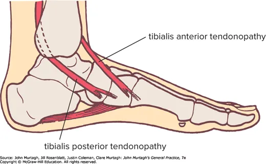 Medial ankle tendon anatomy