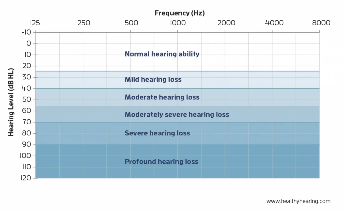 Audiogram showing degrees of hearing loss