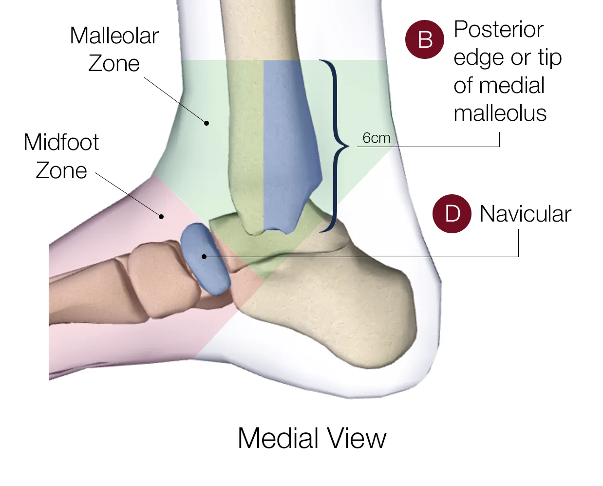 Midfoot zone — medial view
