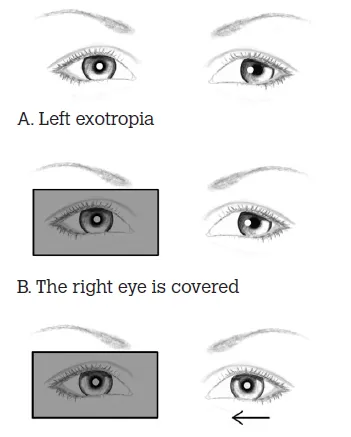 Figure 3. The cover test
