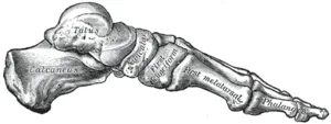 Köhler disease — navicular